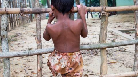 Rohingya child in Bangladesh camp